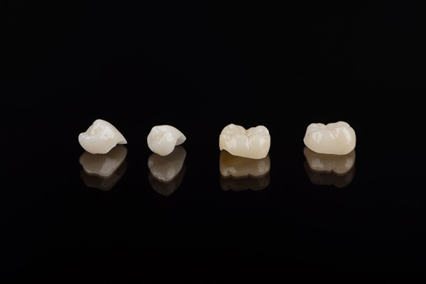 How Many Appointments Are Needed To Get A Dental Crown?