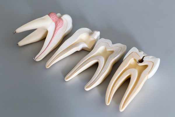 Signs You May Need A Root Canal: When To See A Dentist